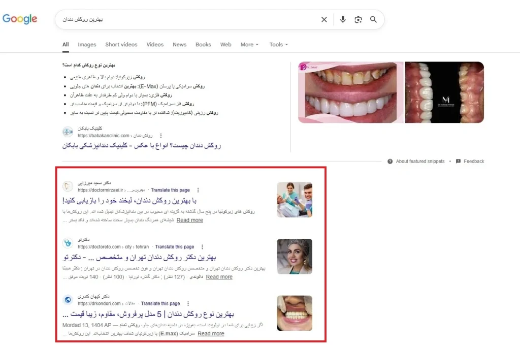 نمونهای از نتایج سئوی معمولی که در هر صفحه 10 لینک آبی نمایش داده میشود